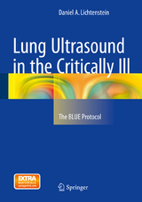 Lung Ultrasound in the Critically Ill - Daniel A. Lichtenstein