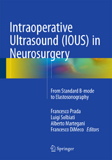 Intraoperative Ultrasound (IOUS) in Neurosurgery - 