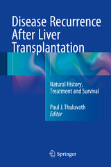 Disease Recurrence After Liver Transplantation - 