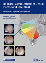 Sinonasal Complications of Dental Disease and Treatment - 