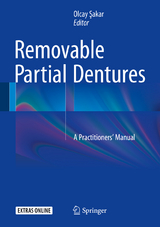 Removable Partial Dentures - 