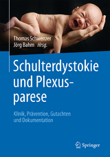 Schulterdystokie und Plexusparese - 