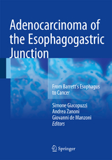 Adenocarcinoma of the Esophagogastric Junction - 