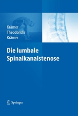 Die lumbale Spinalkanalstenose - Robert Krämer, Theodoros Theodoridis, Jürgen Krämer