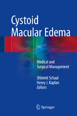 Cystoid Macular Edema - 