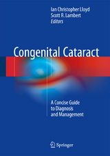 Congenital Cataract - 