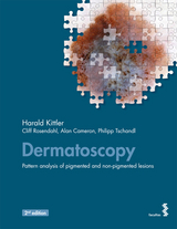 Dermatoscopy - Harald Kittler, Cliff Rosendahl, Alan Cameron, Philipp Tschandl