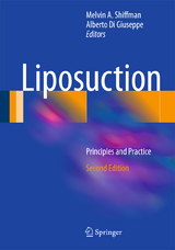 Liposuction - 