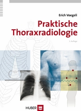 Praktische Thoraxradiologie - Erich Voegeli