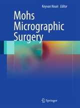 Mohs Micrographic Surgery - 