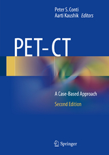 PET-CT - 