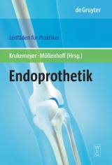 Endoprothetik - 