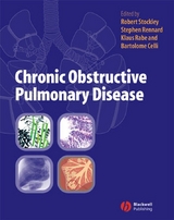 Chronic Obstructive Pulmonary Disease - 