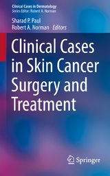 Clinical Cases in Skin Cancer Surgery and Treatment - 