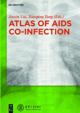 Atlas of AIDS Co-infection - 