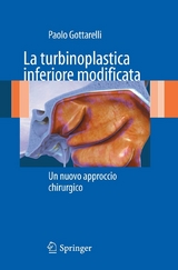 La turbinoplastica inferiore modificata - Paolo Gottarelli