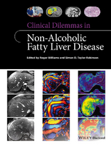 Clinical Dilemmas in Non-Alcoholic Fatty Liver Disease -  Simon D. Taylor-Robinson,  Roger Williams