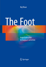 The Foot - Kaj Klaue