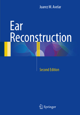 Ear Reconstruction - Avelar, Juarez M.