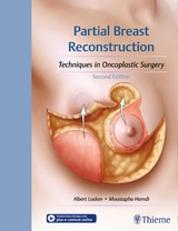 Partial Breast Reconstruction - Losken, Albert; Hamdi, Moustapha