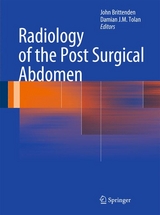 Radiology of the Post Surgical Abdomen - 