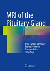 MRI of the Pituitary Gland - Jean-François Bonneville, Fabrice Bonneville, Françoise Cattin, Sonia Nagi