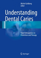 Understanding Dental Caries - 