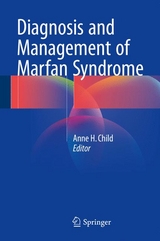 Diagnosis and Management of Marfan Syndrome - 