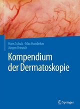 Kompendium der Dermatoskopie - Hans Schulz, Max Hundeiker, Jürgen Kreusch