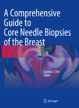 A Comprehensive Guide to Core Needle Biopsies of the Breast - 