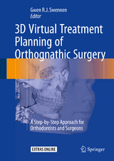 3D Virtual Treatment Planning of Orthognathic Surgery - 