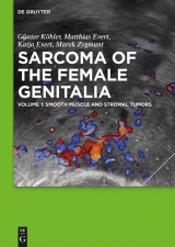 Smooth muscle and stromal tumors and prevention of inadequate surgery -  Günter Köhler