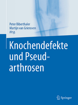 Knochendefekte und Pseudarthrosen - 