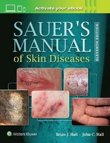 Sauer's Manual of Skin Diseases - Hall, Brian J.; Hall, John C.