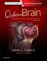 Osborn's Brain - Osborn, Anne G.; Hedlund, Gary L.; Salzman, Karen L.