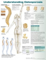 Understanding Osteoporosis Anatomical Chart - 