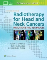 Radiotherapy for Head and Neck Cancers - Garden, Adam S.; Beadle, Beth M.; Gunn, G. Brandon