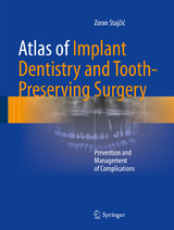 Atlas of Implant Dentistry and Tooth-Preserving Surgery - Zoran Stajčić