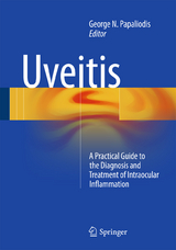 Uveitis - 