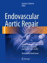 Endovascular Aortic Repair - 