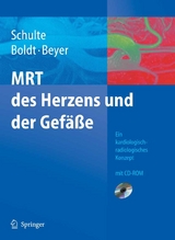 MRT des Herzens und der Gefäße - B. Schulte, A. Boldt, D. Beyer