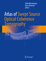 Atlas of Swept Source Optical Coherence Tomography - 