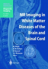 MR Imaging in White Matter Diseases of the Brain and Spinal Cord - 