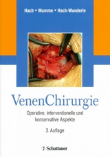 Venen Chirurgie - 