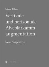 Vertikale und horizontale Alveolarkammaugmentation - Istvan Urban