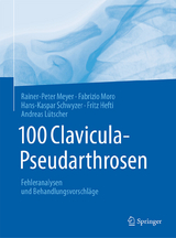 100 Clavicula-Pseudarthrosen - Rainer-Peter Meyer, Fabrizio Moro, Hans-Kaspar Schwyzer, Fritz Hefti