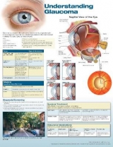 Understanding Glaucoma Anatomical Chart - 