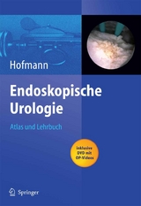 Endoskopische Urologie - 