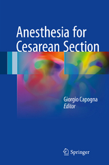 Anesthesia for Cesarean Section - 