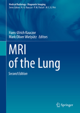 MRI of the Lung - Kauczor, Hans-Ulrich; Wielpütz, Mark Oliver